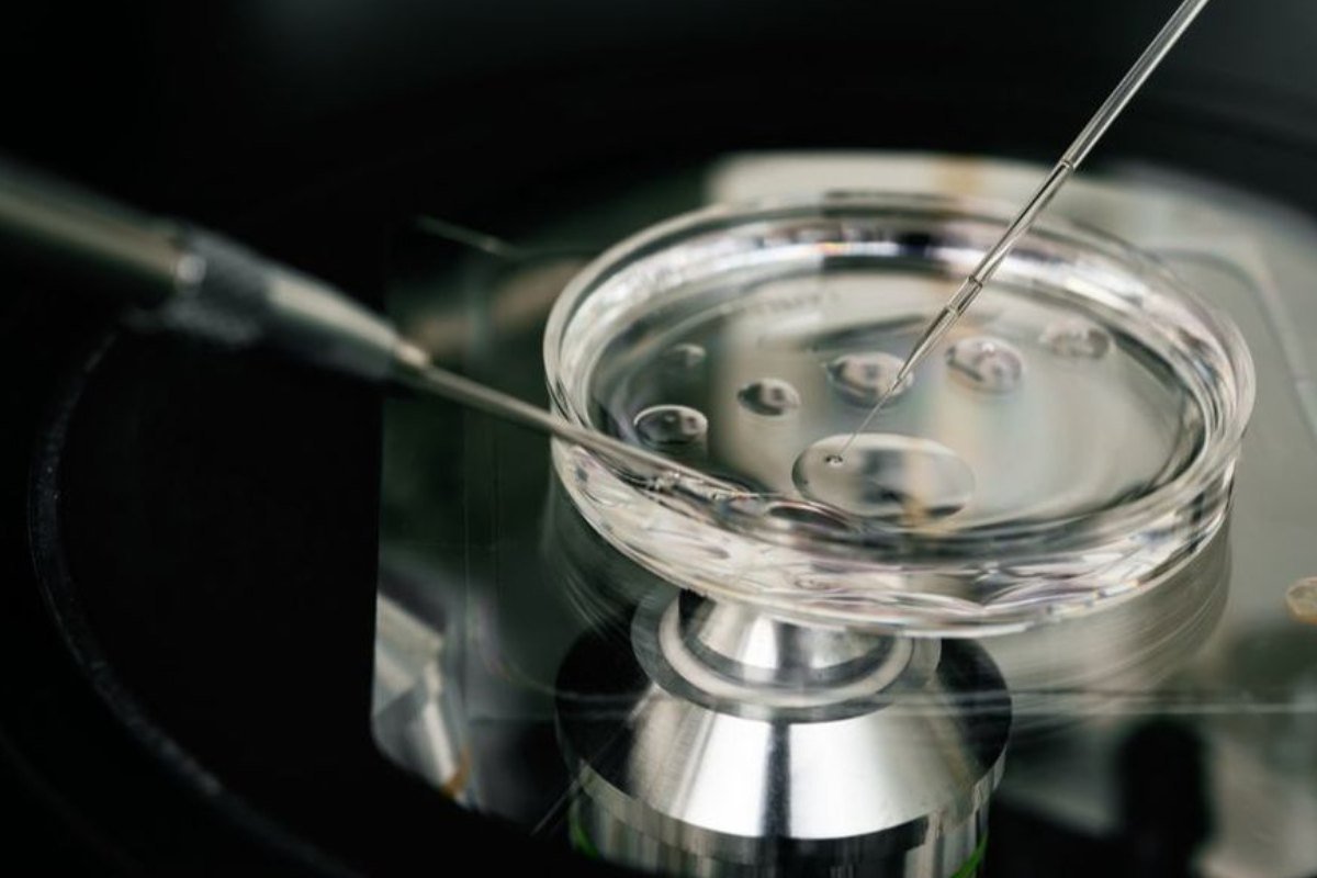 ICSI Treatment